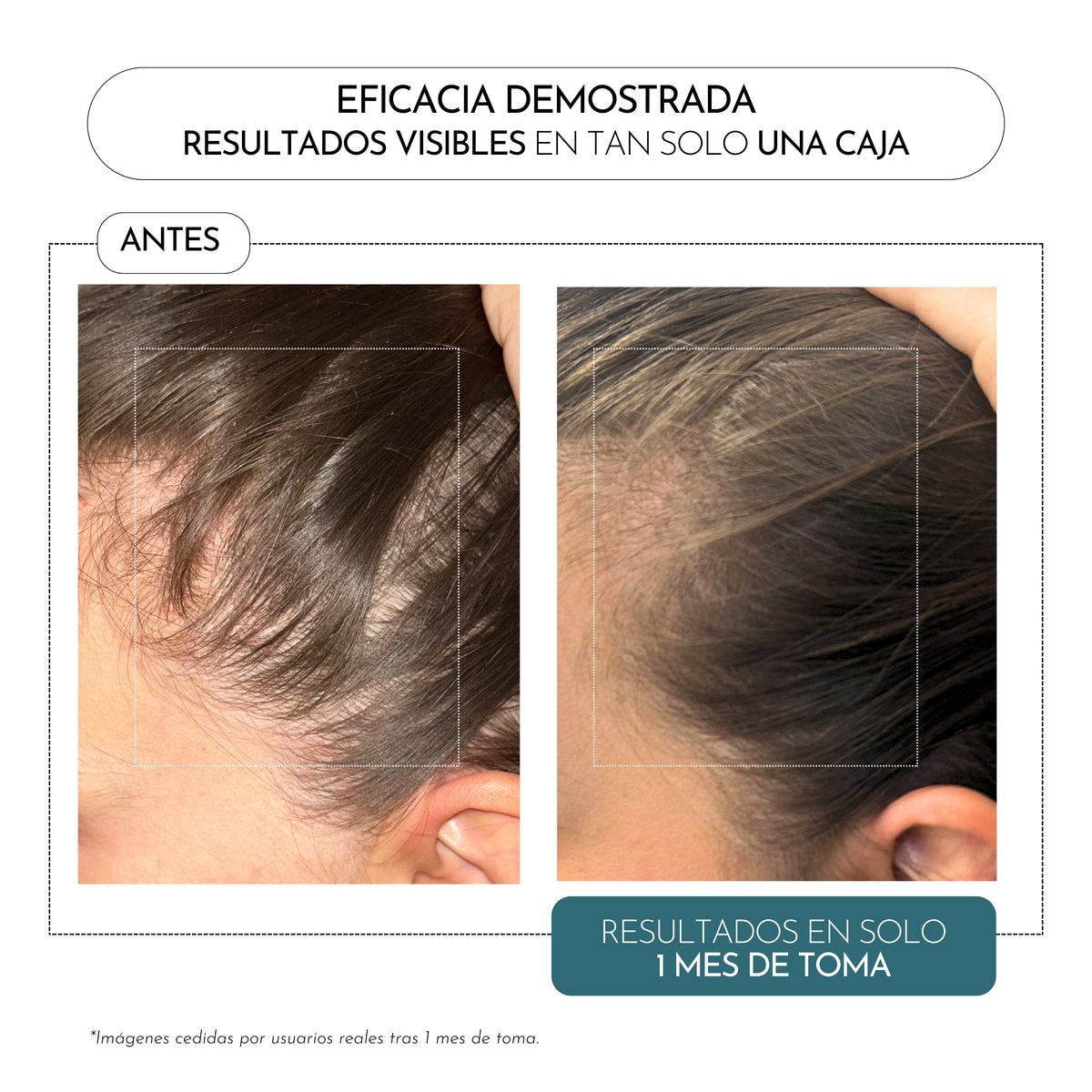HAIR FORMULA