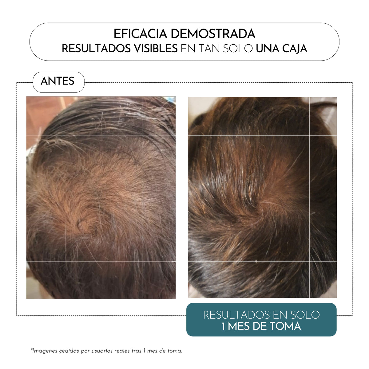 HAIR FORMULA